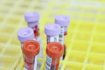 What Happens When You Have Abnormal Blood Work? - LabMe