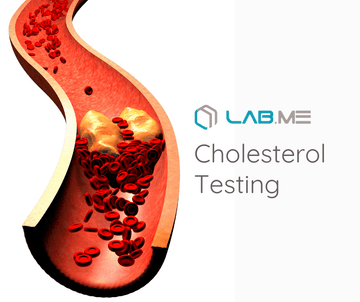 How to Test Your Cholesterol Levels at Home - Lab Me